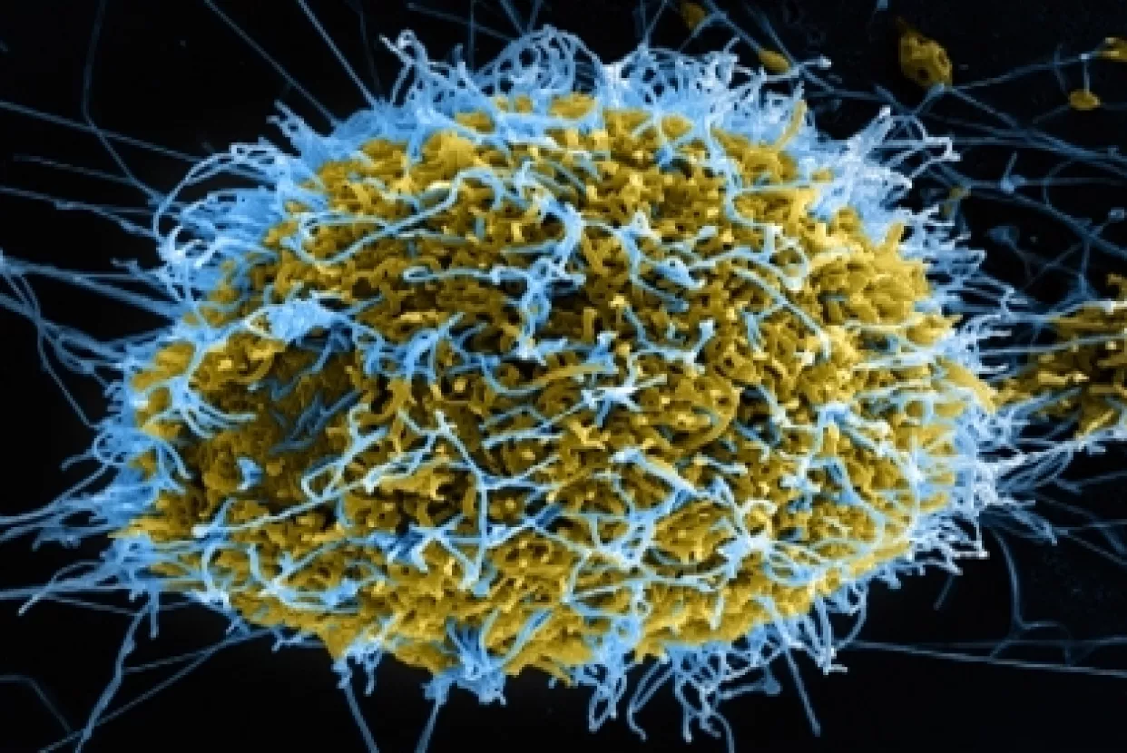 Do studenog bi broj oboljelih od ebole mogao dosegnuti brojku od 20 tisuća