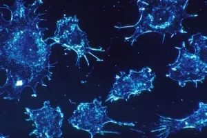 Glavni razlog zbog kojeg ljudi obolijevaju od karcinoma jest – loša sreća