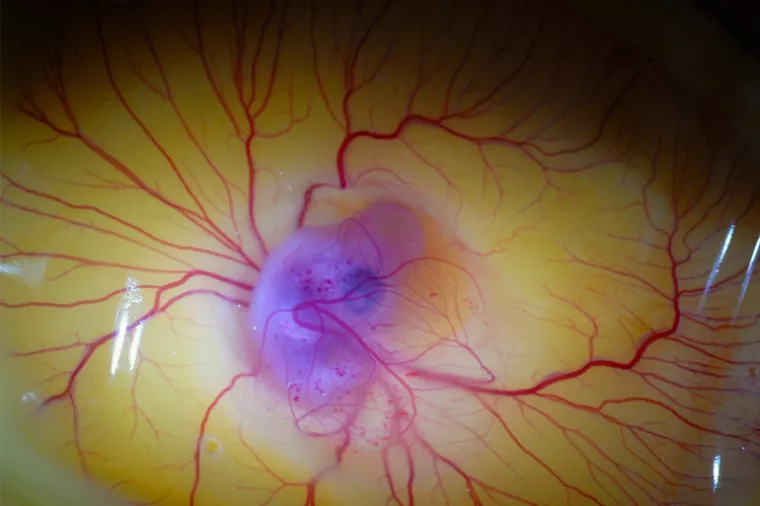 Švedski znanstvenik istraživanjem gena embrija ulazi u tabu zonu genetski modificirane djece