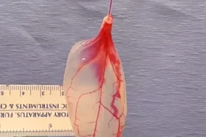 Otkriće koje obećava: Znanstvenici od lista špinata uzgojili ljudsko srčano tkivo