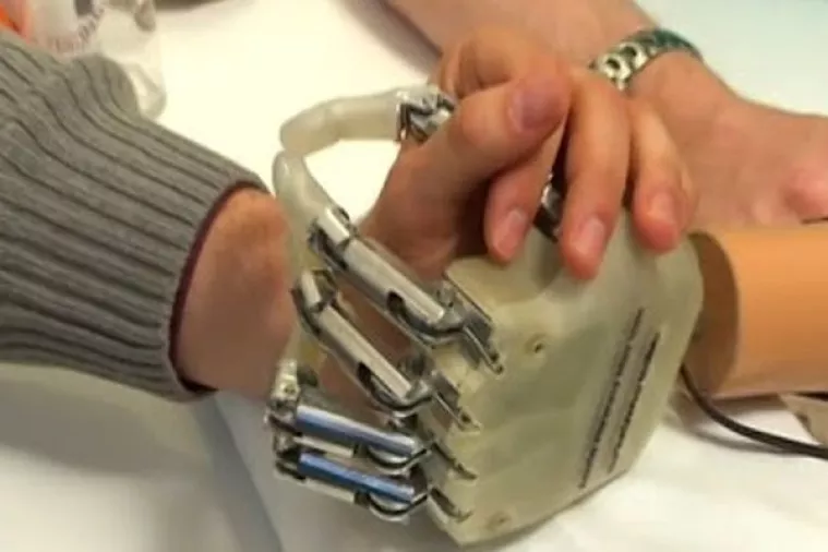 VIDEO: Pacijentica dobila prvu osjetilnu bioničku ruku