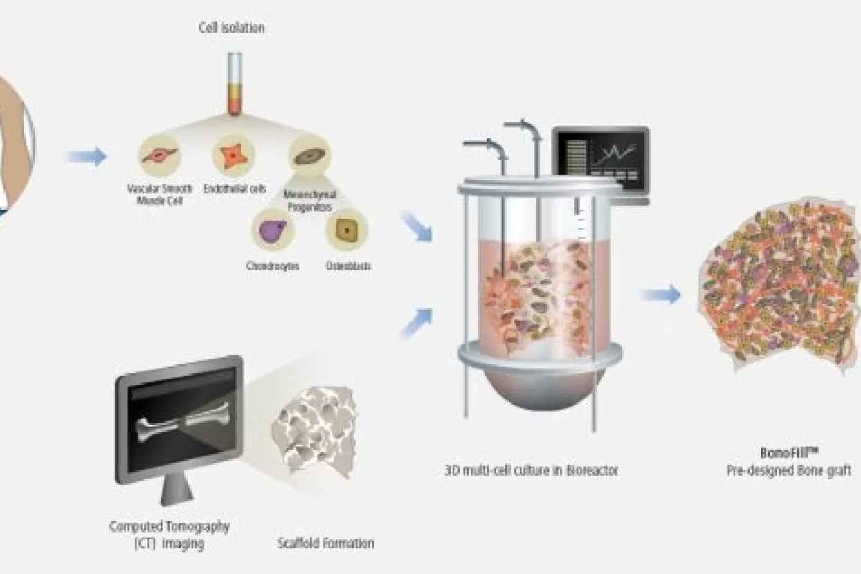 Izraelska biotech kompanija uspješna u uzgoju i regeneraciji kostiju