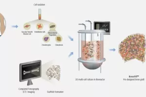 Izraelska biotech kompanija uspješna u uzgoju i regeneraciji kostiju
