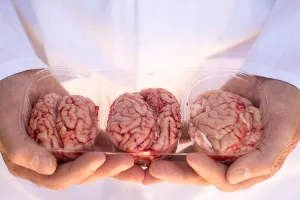 'Frankenštajnski pothvat': Znanstveni tim Nenada Šestana aktivirao svinjski mozak izvan tijela