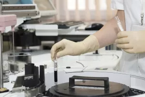 Razvijen točniji i jeftiniji krvni test za otkrivanje alergije na kikiriki