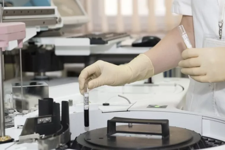 Razvijen točniji i jeftiniji krvni test za otkrivanje alergije na kikiriki