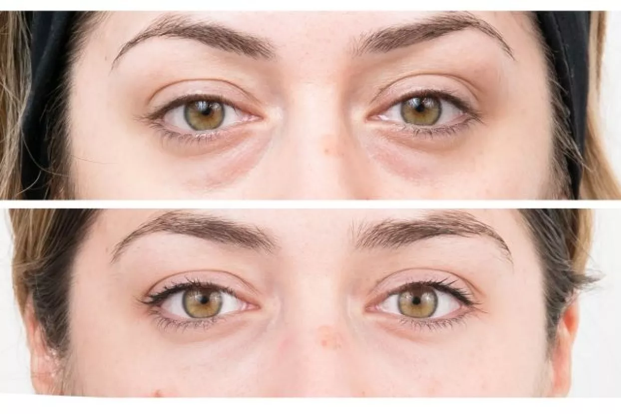 Poslovni uspjeh ne mora ostavljati tragove na vašem tijelu