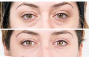 Poslovni uspjeh ne mora ostavljati tragove na vašem tijelu