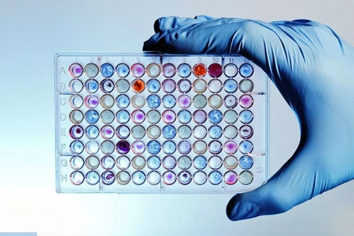 VIDEO: Provjerite jesu li vaši geni kameni, skandinavski ili...