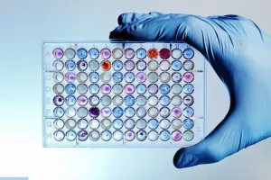 VIDEO: Provjerite jesu li vaši geni kameni, skandinavski ili...