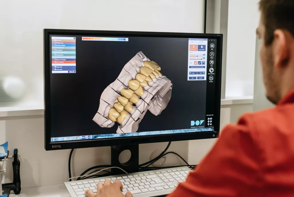 Digitalna revolucija stomatologije: Brzo, ugodno i bezbolno!
&nbsp;