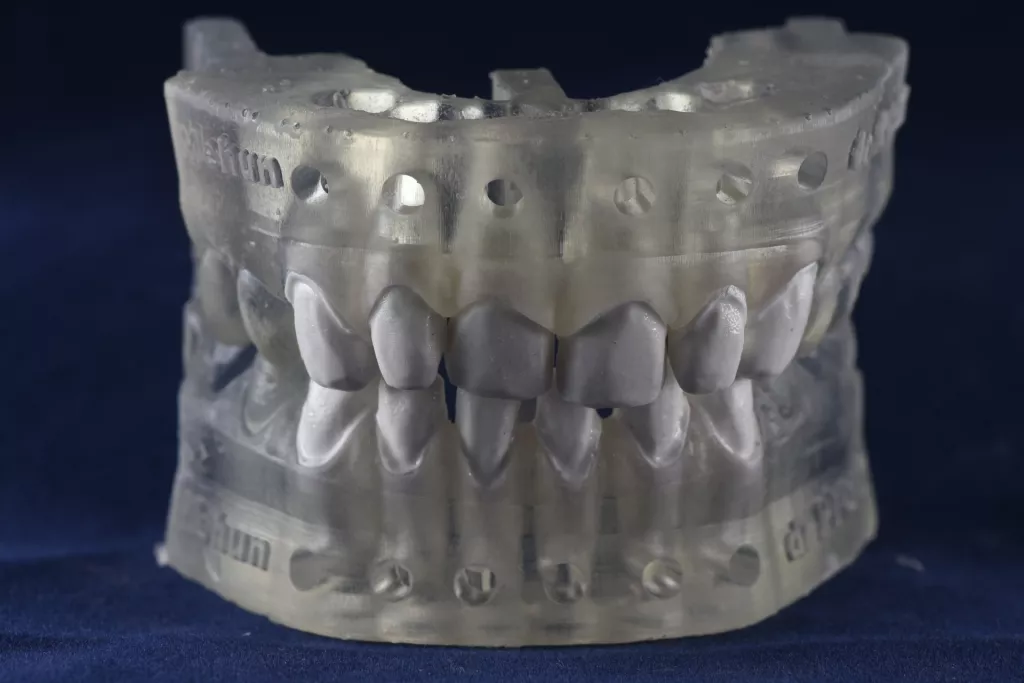 [Poslovna scena] Brazilski zubi iz matičnih stanica prijete Mehunovim protezama iz 3D printera