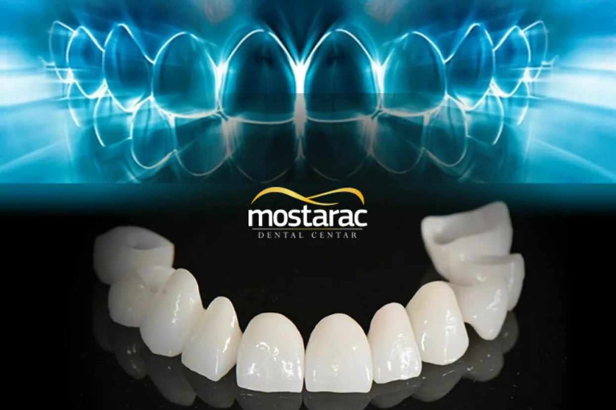 Mostarac promo