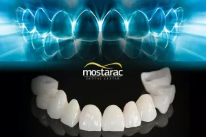 Mostarac promo