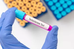 Testosteron hormon test
