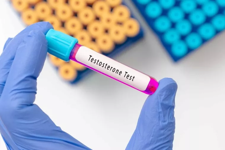 Testosteron hormon test